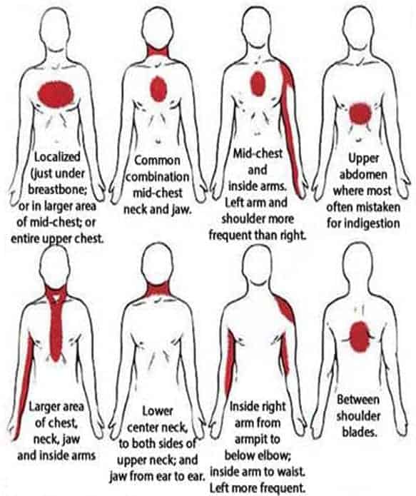 early signs of heart disease