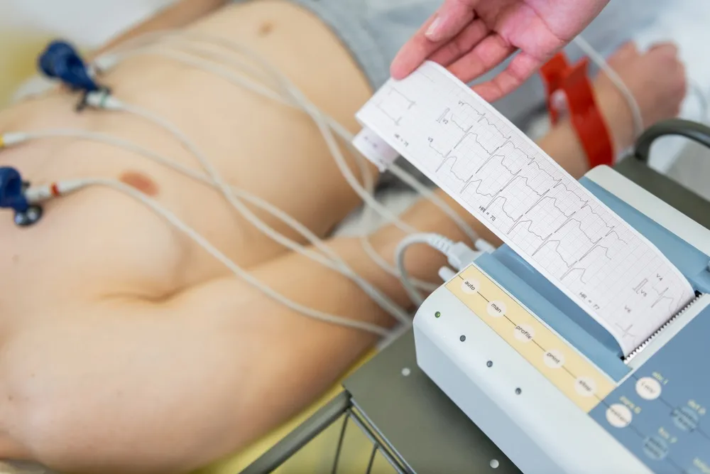 8 Tests You Can Expect During a Check-up in a Heart Specialist Clinic in Singapore